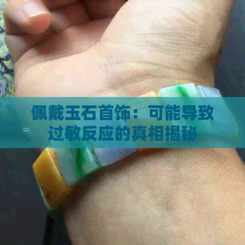 佩戴玉石首饰：可能导致过敏反应的真相揭秘