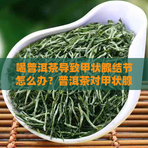 喝普洱茶导致甲状腺结节怎么办？普洱茶对甲状腺结节有好处吗？