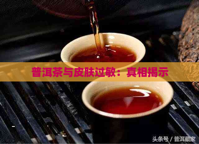 普洱茶与皮肤过敏：真相揭示