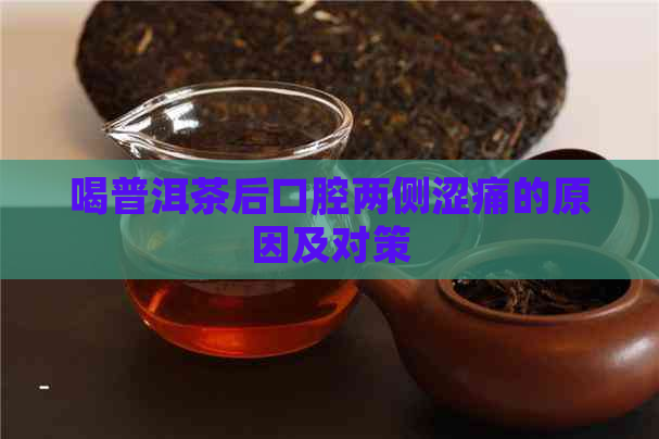 喝普洱茶后口腔两侧涩痛的原因及对策