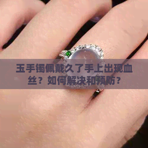 玉手镯佩戴久了手上出现血丝？如何解决和预防？