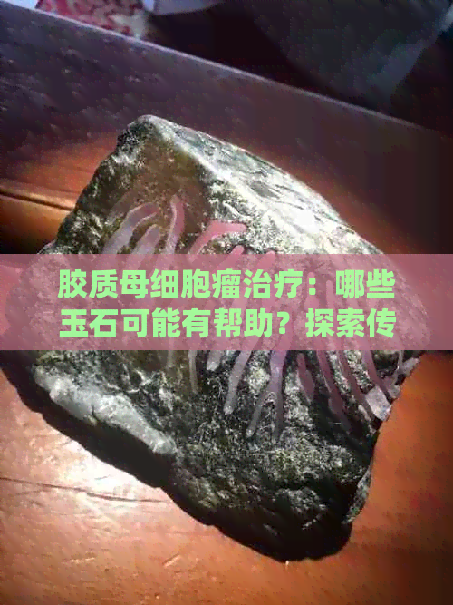 胶质母细胞瘤治疗：哪些玉石可能有帮助？探索传统和现代疗法的结合