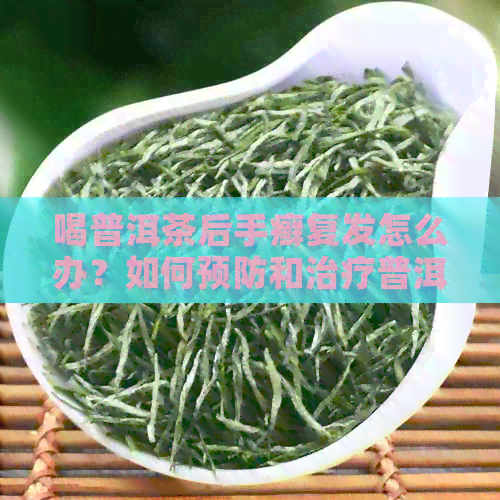 喝普洱茶后手癣复发怎么办？如何预防和治疗普洱茶引发的手癣问题？