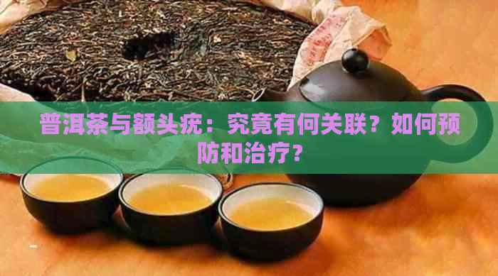 普洱茶与额头疣：究竟有何关联？如何预防和治疗？