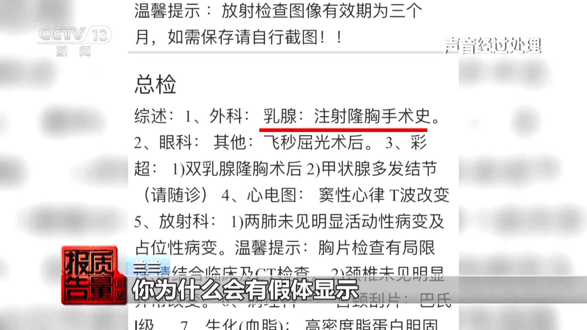 全面解析雅光玉的特点、质量和购买建议，解答用户关于是否值得购买的疑虑