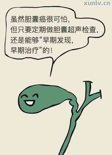 割了胆囊可以喝普洱茶吗