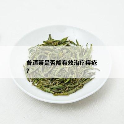 普洱茶对女性痔疮患者的影响及治疗建议：医生的专业指导