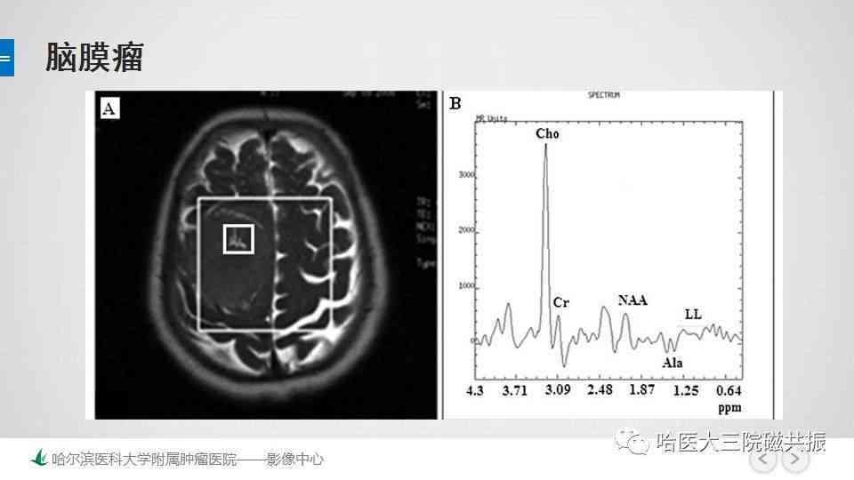 磁共振成像技术在疾病诊断中的应用和注意事项