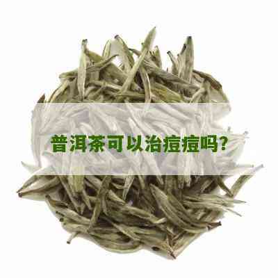 普洱茶能祛痘吗？怎么喝？是真的吗？有效果吗？可以祛痘吗？