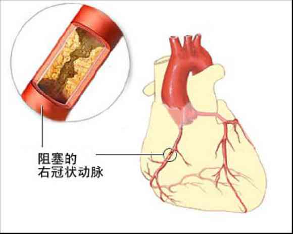 哪种玉石对心脏有益？——翡翠、和田玉与佩戴的全方位解析