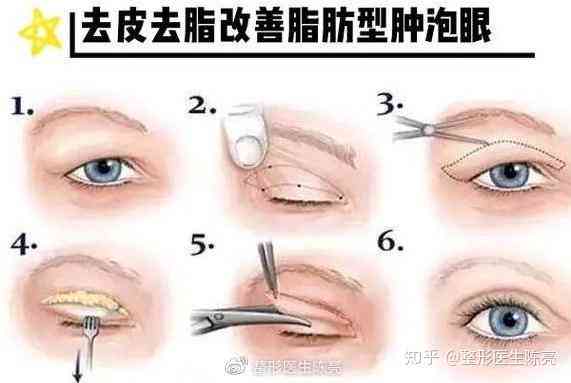 普洱茶对眼睛浮肿的影响：原因、解决方法及可能的风险