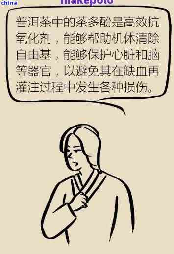 颈动脉血管塞能喝普洱茶吗：专家建议女性患者谨饮用