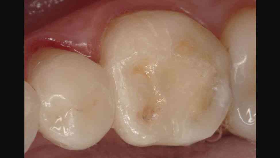 德化羊脂玉瓷的安全性分析：对身体无害的可能性研究