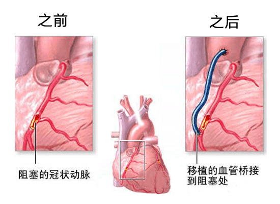 什么玉石对心脏血管有好处和坏处：全面解析