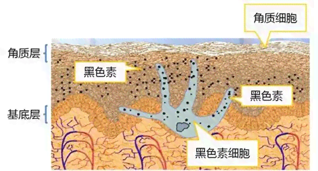 银子摩擦皮肤变黑的原因及解决方法全面解析：了解科学原理和预防措施