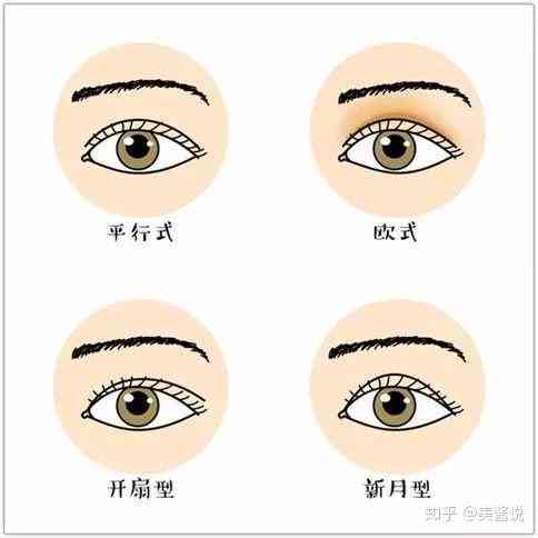 翡翠蛋面双眼皮：原理、适用人群、手术风险及恢复期全面解析