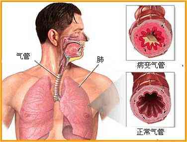 老年人配戴玉佛的适宜性及相关注意事项