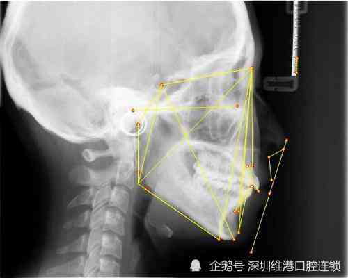 翡翠牌子的厚薄与质量之间的关系：如何判断？有哪些标准和方法？