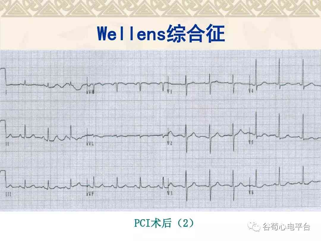 普洱茶对心率的影响：加快还是减缓？喝茶前后的心率变化如何？