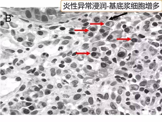 莫西沙的皮壳：结构特征、颜色变化及生物学意义