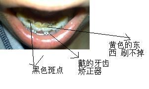 端砚上有斑点的几块黄颜色是什么？