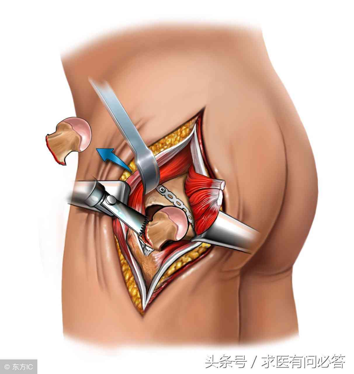 逾期一天还款后，再次借款机会受限：了解分期政策和影响因素