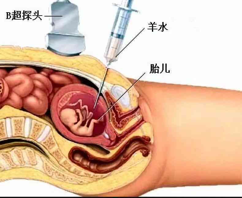 鸡血玉养护方法与安全性分析，你真的了解吗？