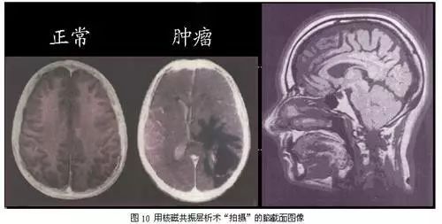 翡翠在核磁共振成像下的真实颜色：一次全面的解读