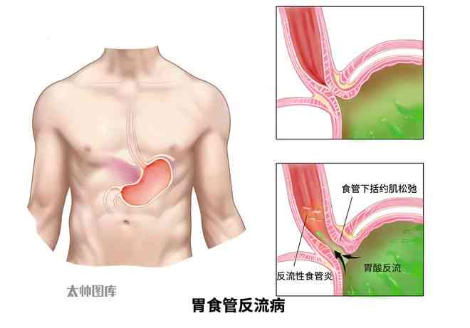 如何解决戴玉吊坠卡喉咙的问题：原因、预防和解决方法