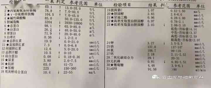 喝茶缓解嗓子干燥的有效性及相关研究