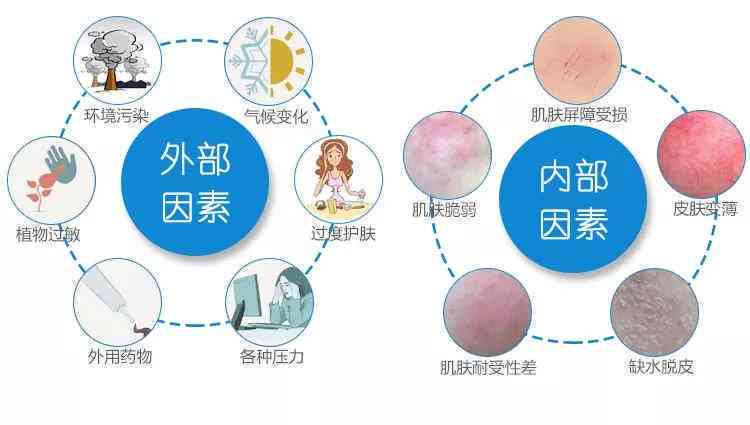 莫西沙枯藓怎么看有没有好转：有效治疗及预防措施