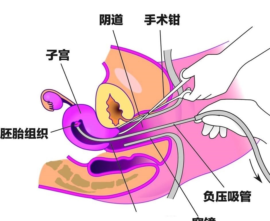 佘太翠：佩戴适宜性及保养方法全方位解析，确保长期佩戴效果