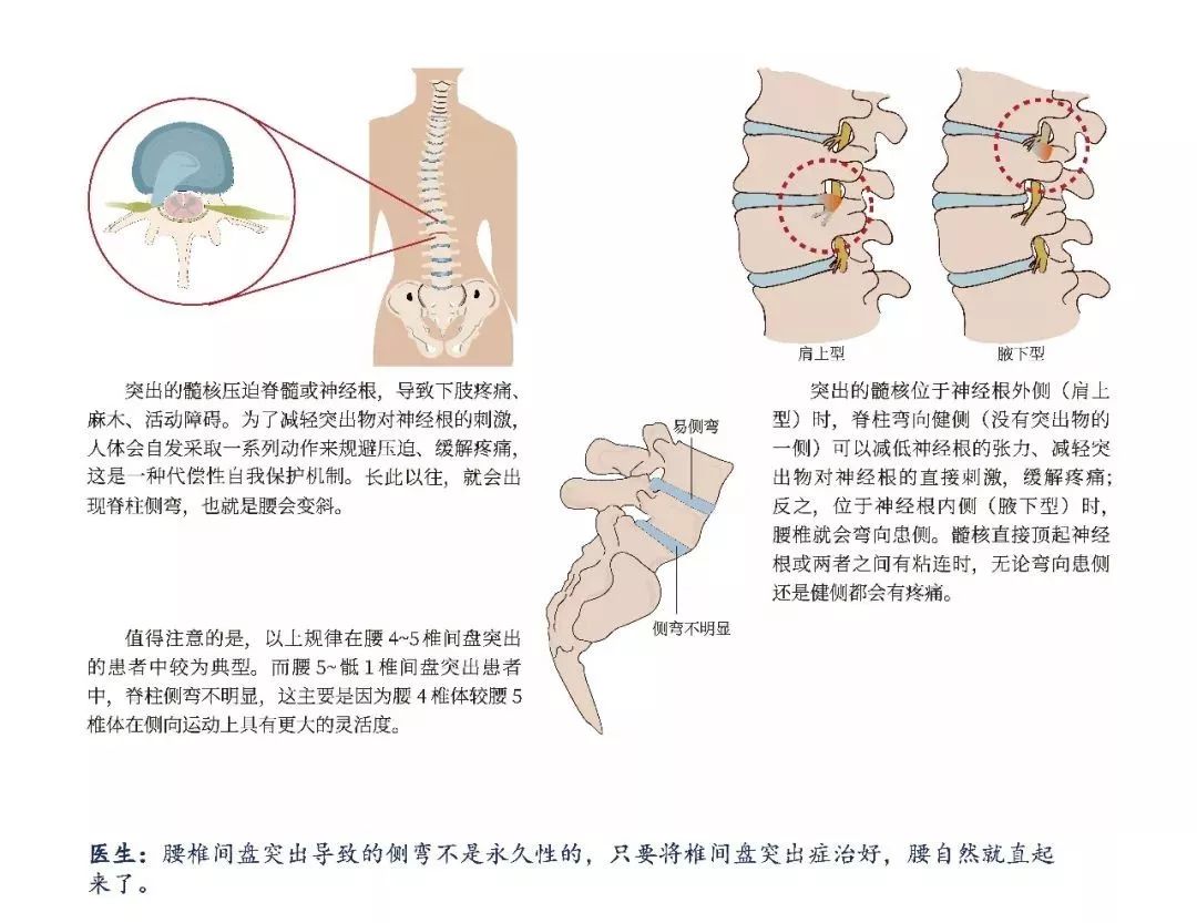 腰部热敷对肾脏的影响：科学研究与误解解析