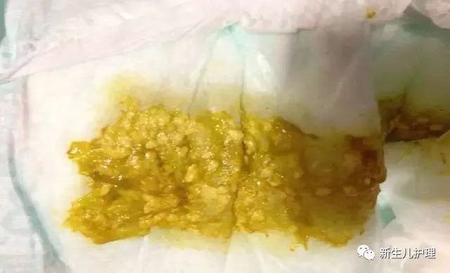 古树茶饮用后腹泻问题解答：原因、预防与改善方法