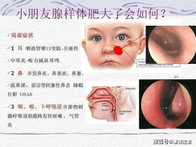 喝普洱茶舌苔变黑是怎么回事：探究原因与影响