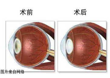 玉髓对眼睛健康的影响及其适用性