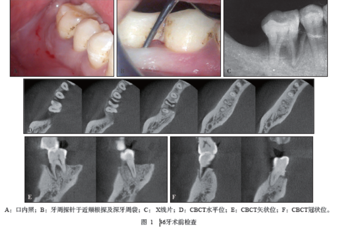 白玉髓带久了发黄：原因、处理与正常性探究