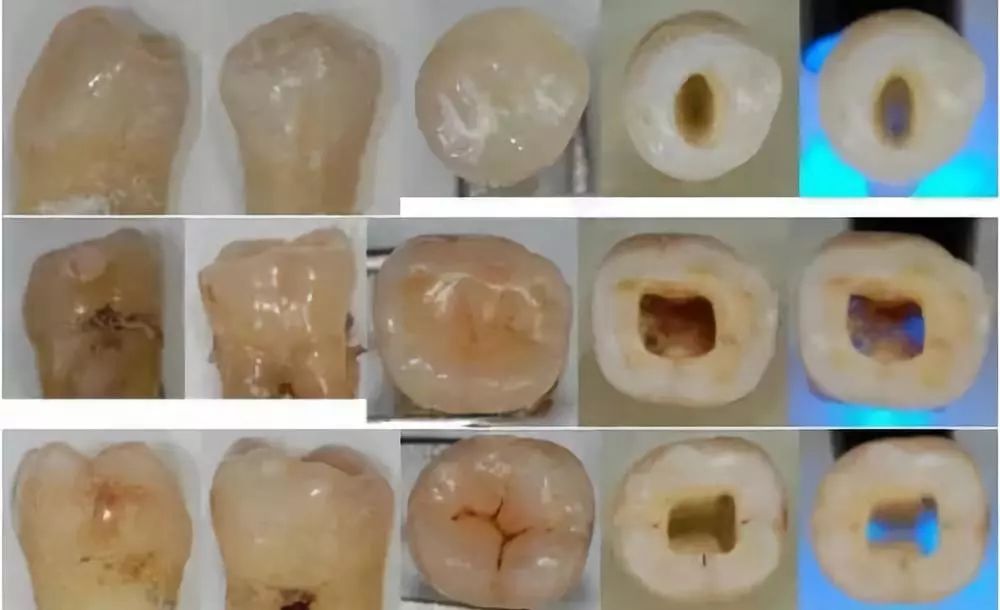 白玉髓带久了发黄：原因、处理与正常性探究