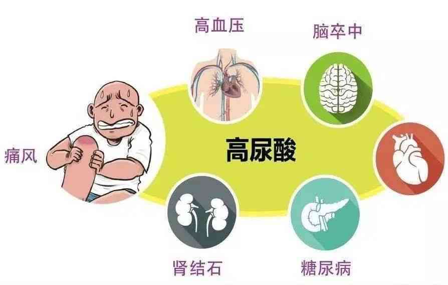 绿茶对尿频尿急症状的缓解作用：科学研究与喝茶建议