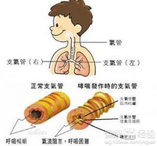 哮喘性支气管炎患者喝普洱茶的好处及注意事项