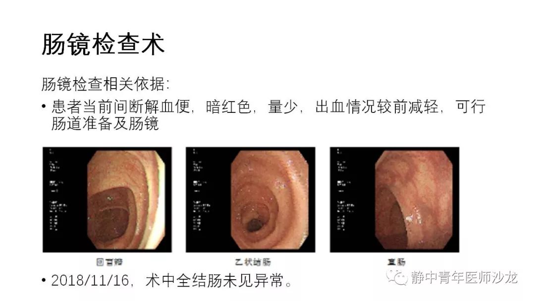 普洱茶舌根发麻的原因分析及其影响因素