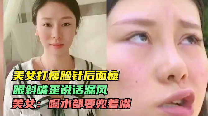 面瘫可以喝普洱茶么嘛女性