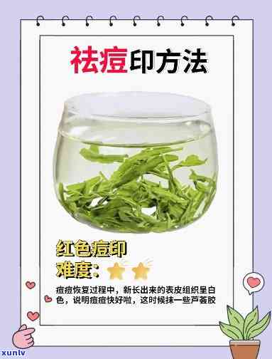 新 喝茶叶水对痘印有帮助吗？了解你不知道的痘印治疗方法