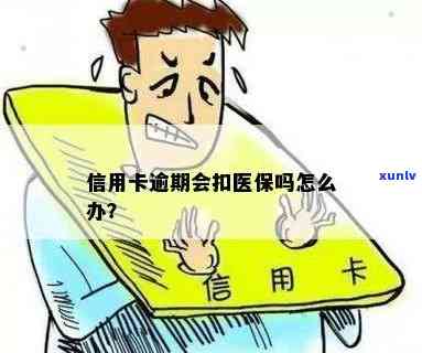 '逾期扣款医保卡是否还能继续使用？如何处理，逾期后医保卡是否可用？'