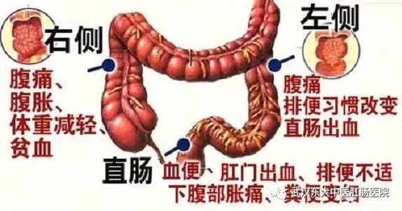 茶后立即排便正常吗？探讨饮茶与消化系统的关系