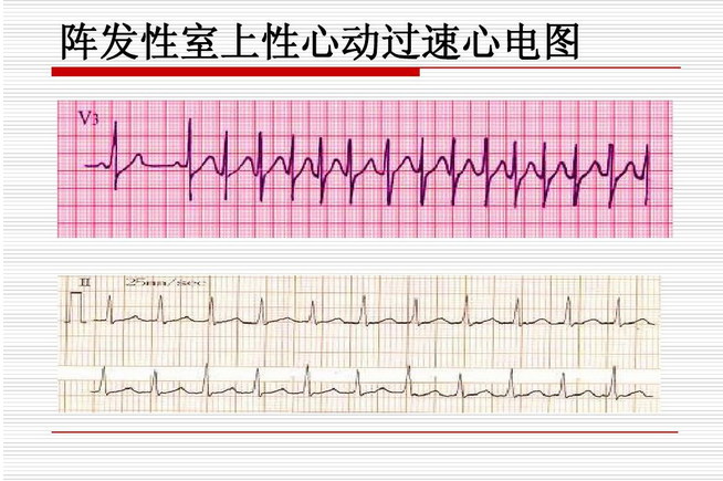 玉的颜色会随体温不同而变吗为什么不一样-玉的颜色会随体温不同而变吗为什么不一样呢