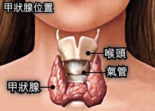 甲状腺癌手术后饮食：红茶是否适宜饮用？术后的饮食调整与复要点解析