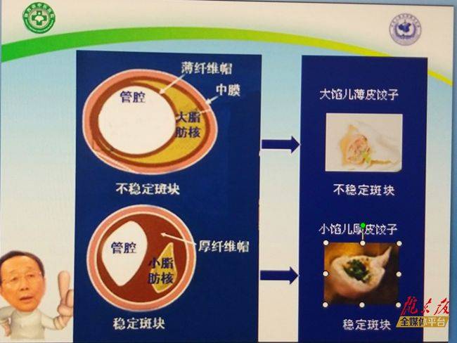 降血脂、血压、血糖的理想茶饮选择及其功效解析