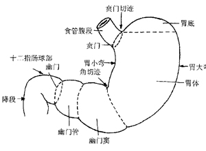 普洱茶：对胃反流症状的有效性和可能的副作用全面解析