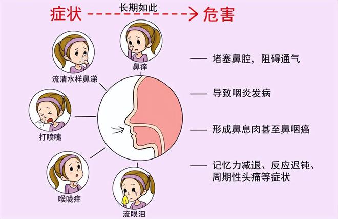 茶叶过敏性鼻炎：原因、影响与缓解方法